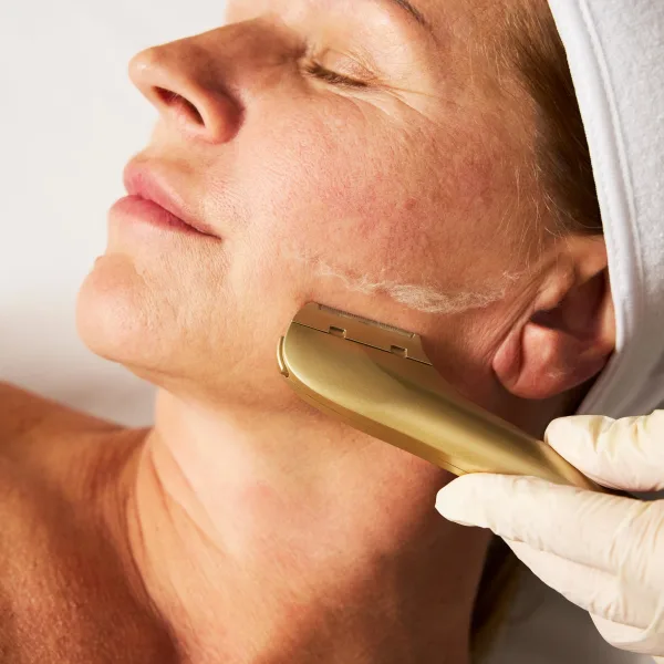 Patented device for estheticians combines exfoliation and peach fuzz removal with precision, safety, and clinical results after a single use