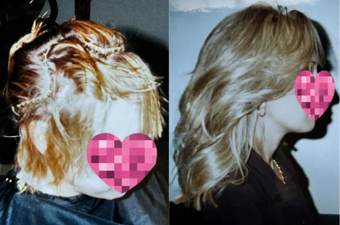 before and after of client with net method hair replacement