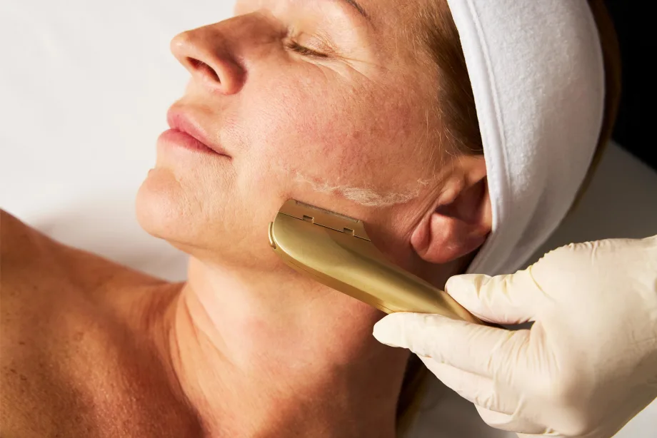 Patented device for estheticians combines exfoliation and peach fuzz removal with precision, safety, and clinical results after a single use
