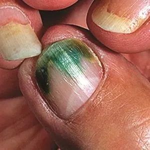 What to Tell Clients When They Have Green Nails