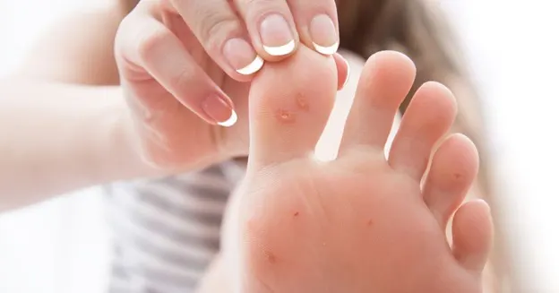 Protecting Your Clients From Viral Infections