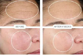 Skincare Clients Can Prepare for Fall with StriVectin