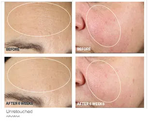 Skincare Clients Can Prepare for Fall with StriVectin